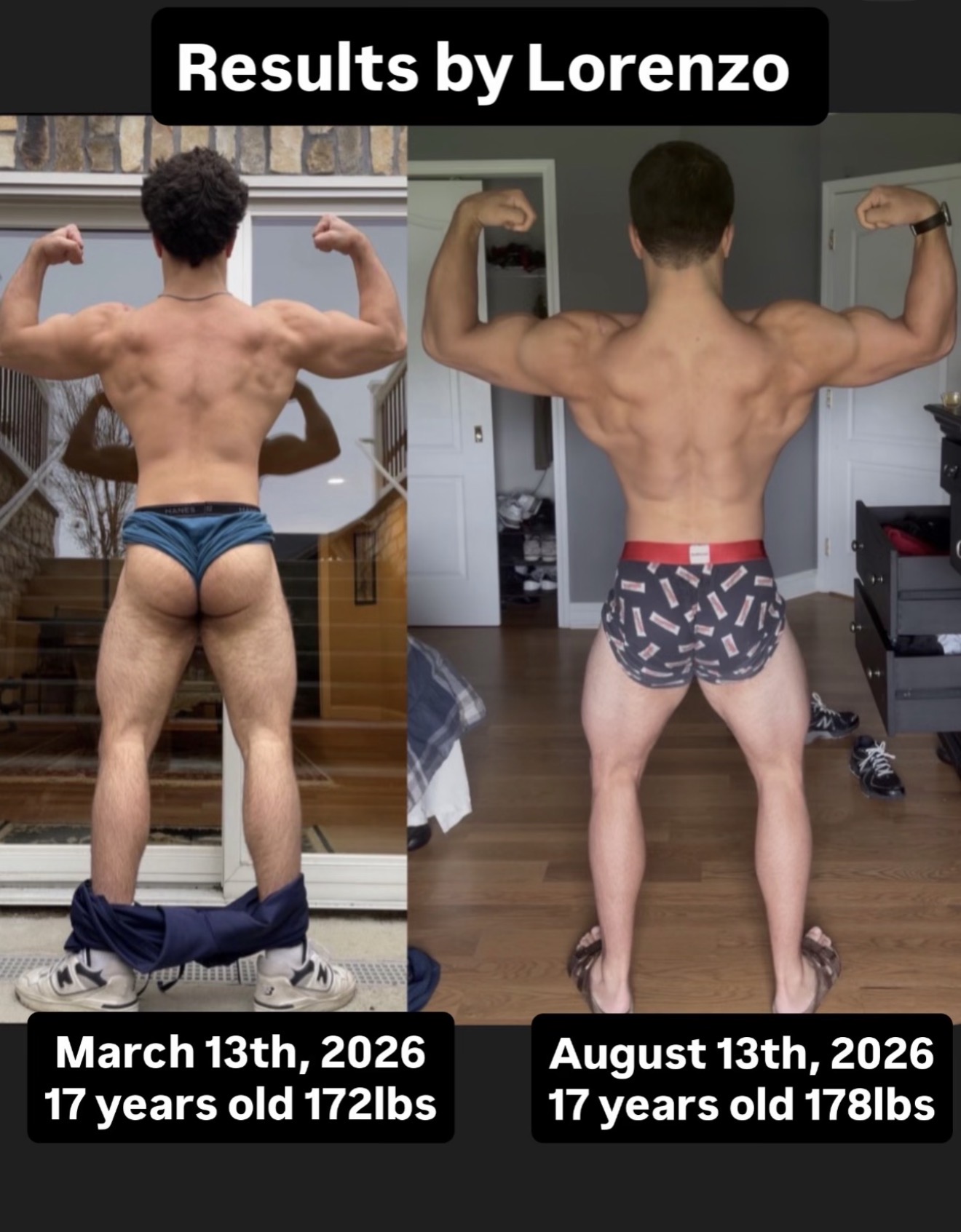 Seventeen-year-old male back transformation from March to August 2026
